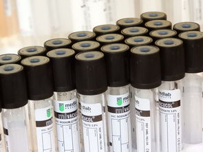 科技期刊，科学进步的催化剂  第1张